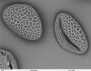 Back-scattered electron microscope image of pollen grains from Lilium auratum (oriental lily). This image is in the public domain. https://remf.dartmouth.edu/images/botanicalPollenSEM/source/3.html