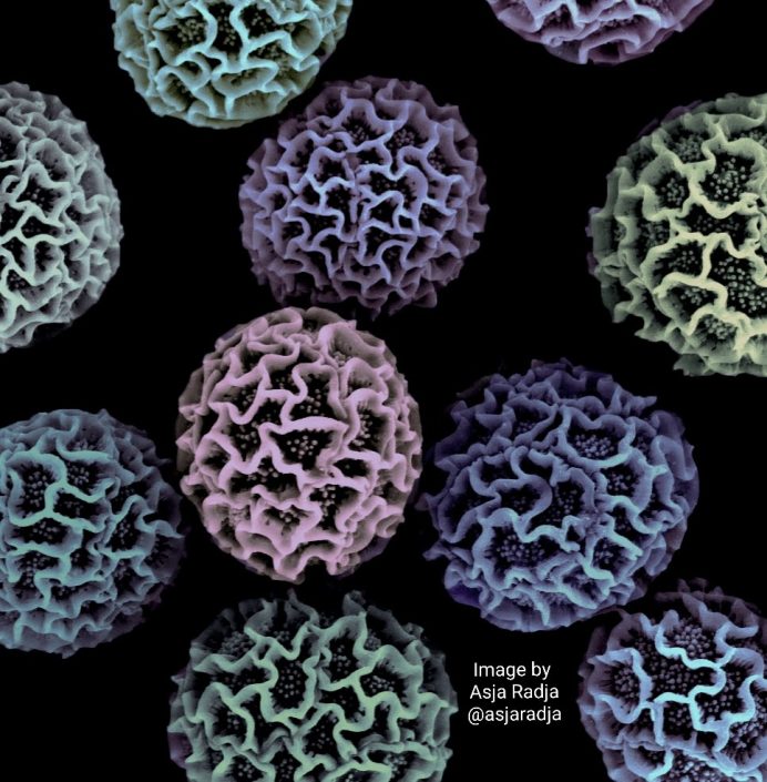 Scanning electron micrograph of false colored Passiflora (passionvine), Spathiphyllum (peace lily), and Aster (daisy) pollen showing intraspecific pattern stability and interspecific pattern variation. Image by Asja Radja. [CC BY 4.0 (https://creativecommons.org/licenses/by/4.0)], from Wikimedia Commons.