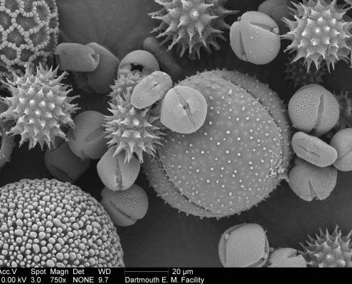 Scanning electron microscope image of pollen mix (Louisa Howard). This image is in the public domain. http://remf.dartmouth.edu/pollen2/pollen_images_1/